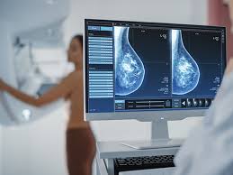 Bezpłatna mammografia w powiecie oświęcimskim. Sprawdź harmonogram mammobusów w lutym 2026